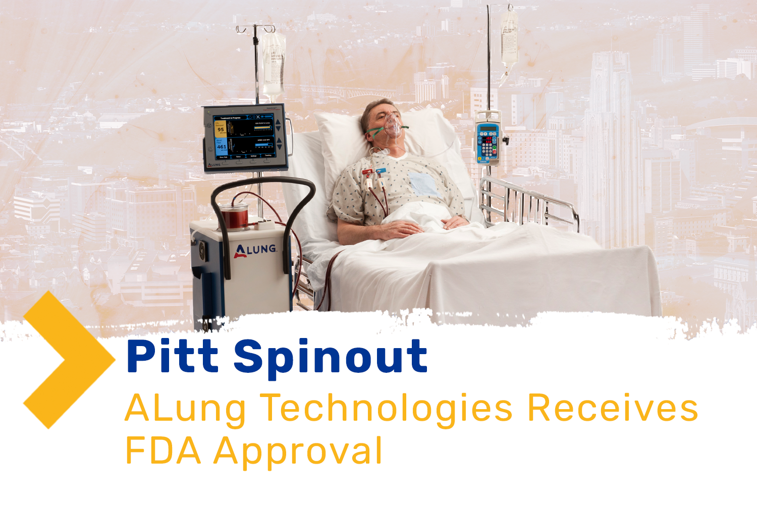 Alung FDA Approval