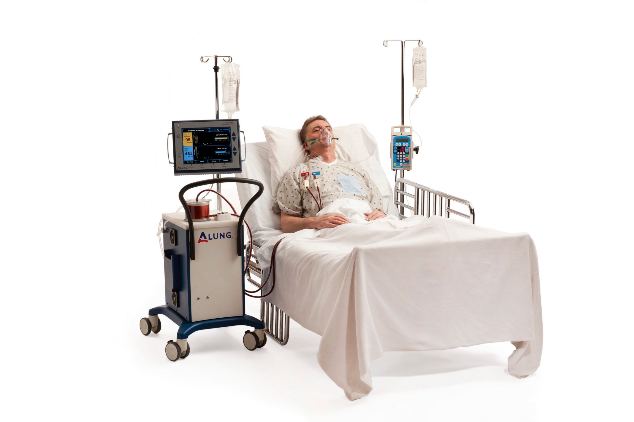 Hemolung System on patient